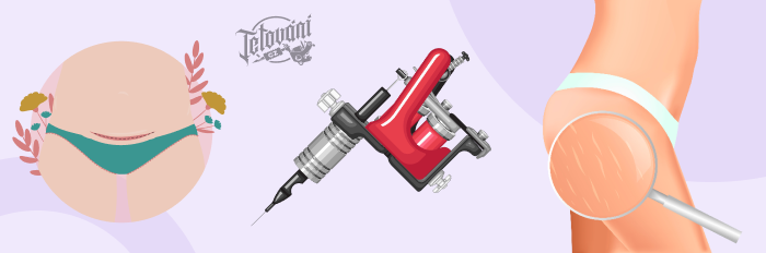 tetování přes strie